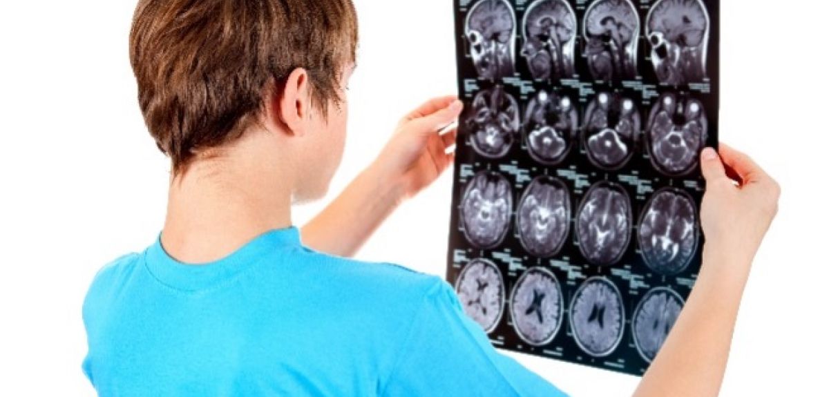 Incidence and Economic Burden of Concussion across UK Sport